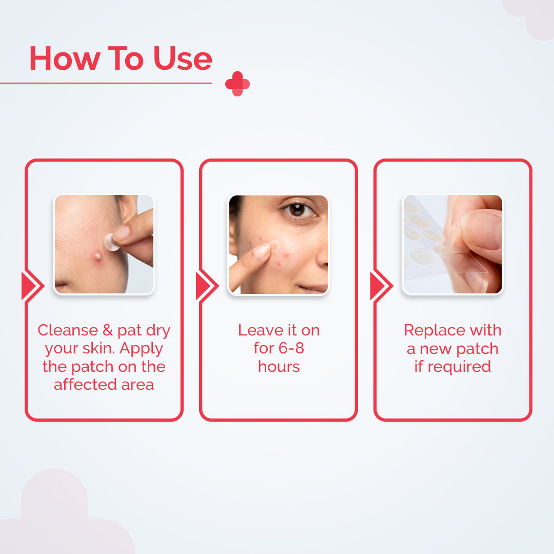 2% Sali-Cinamide Hydrocolloid Acne Patches - 36 Patches