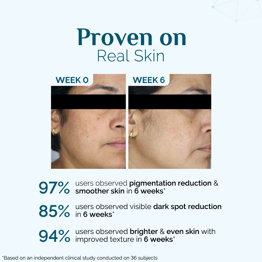 Skin Renew Hyperpigmentation Peptide Serum - 30 ml