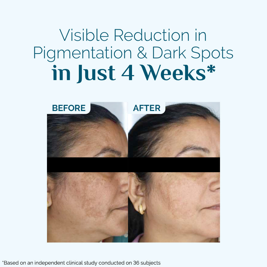 Skin Renew Hyperpigmentation Peptide Serum - 30 ml