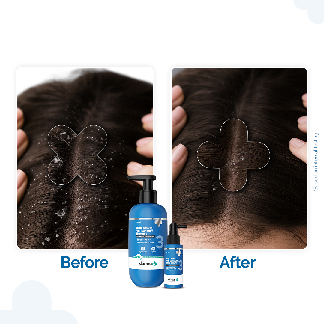 Triple Actives Anti-Dandruff Control Combo