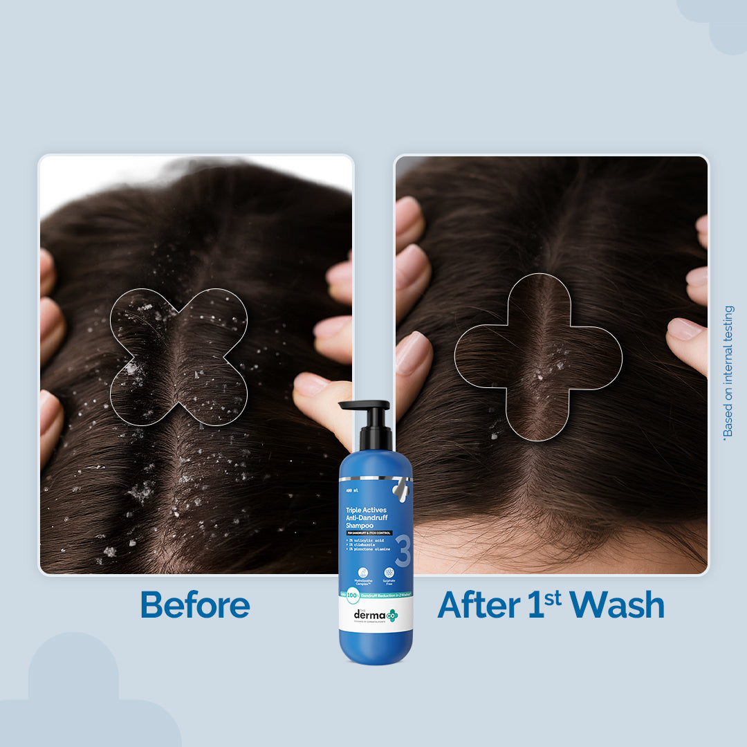 Triple Actives Anti-Dandruff Shampoo - 400ml