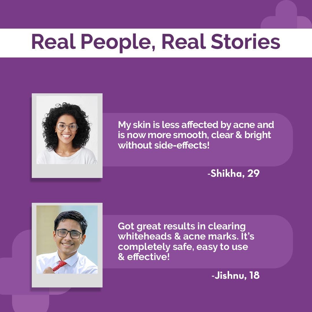 30% AHA + 2% BHA Peeling Solution - 30ml