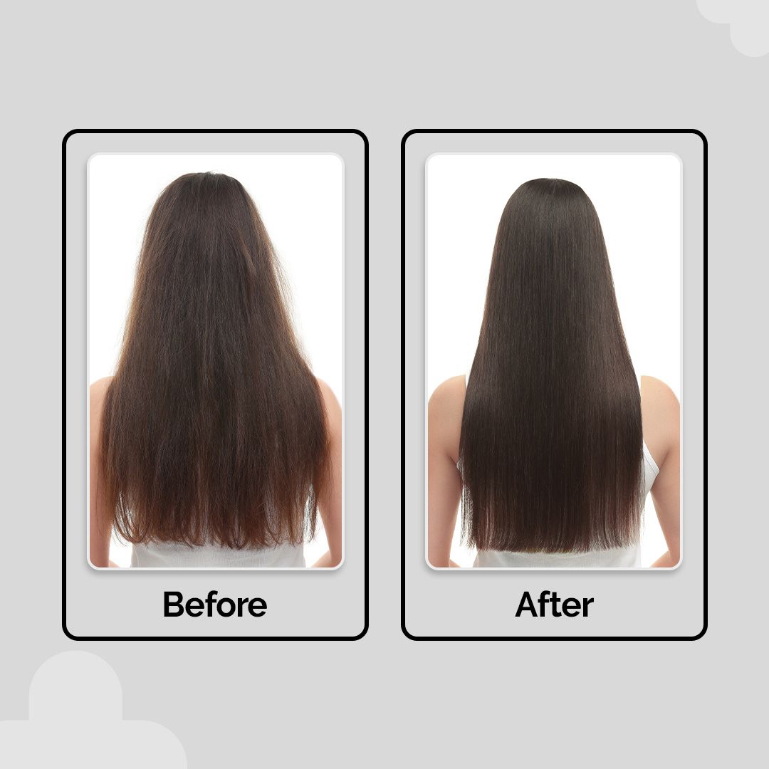 Anti-Hairfall Essentials Duo