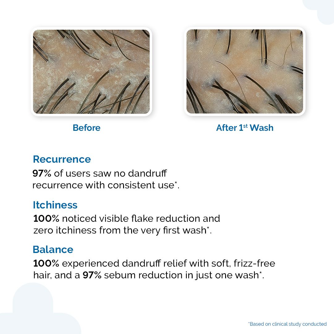 Triple Actives Anti-Dandruff Shampoo - 200 ml