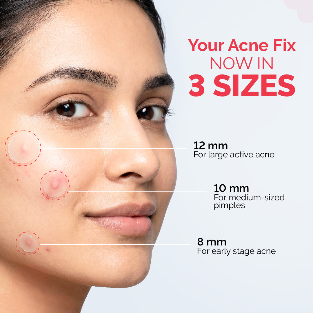 2% Sali-Cinamide Hydrocolloid Acne Patches - 36 Patches