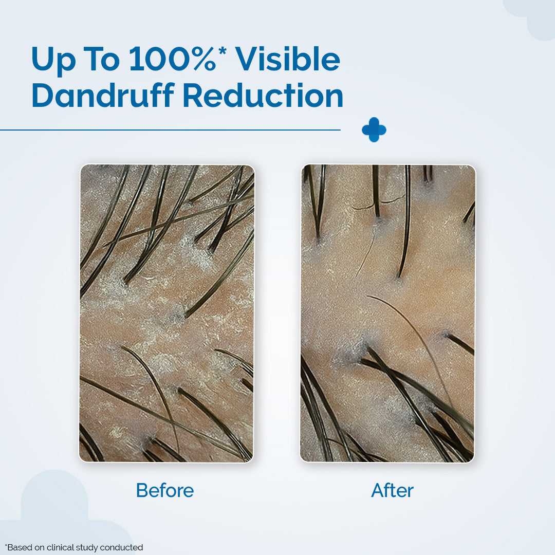 Triple Actives Anti Dandruff Shampoo 50ml