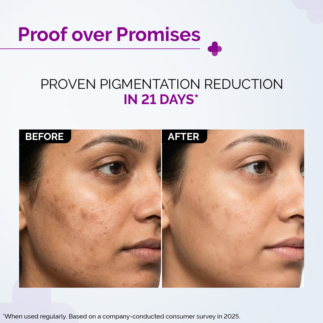 plix glutathione before and after Skin Glow Tablet & Serum Pineapple Serum Combo - 15 Tabs+30ml Plix Glutathione Skin Glow Review