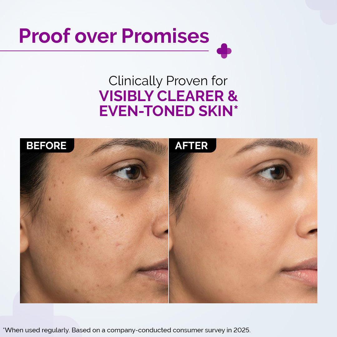 10% Niacinamide Face Serum with 2% Zinc PCA - 30ml