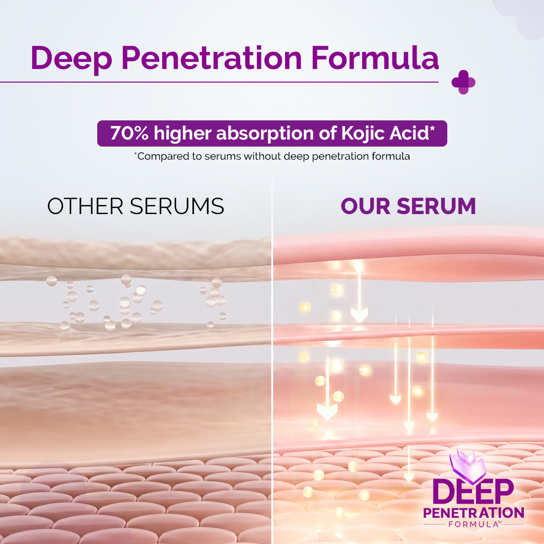 2% Kojic Acid Face Serum with 1% Alpha Arbutin & Niacinamide - 30 ml