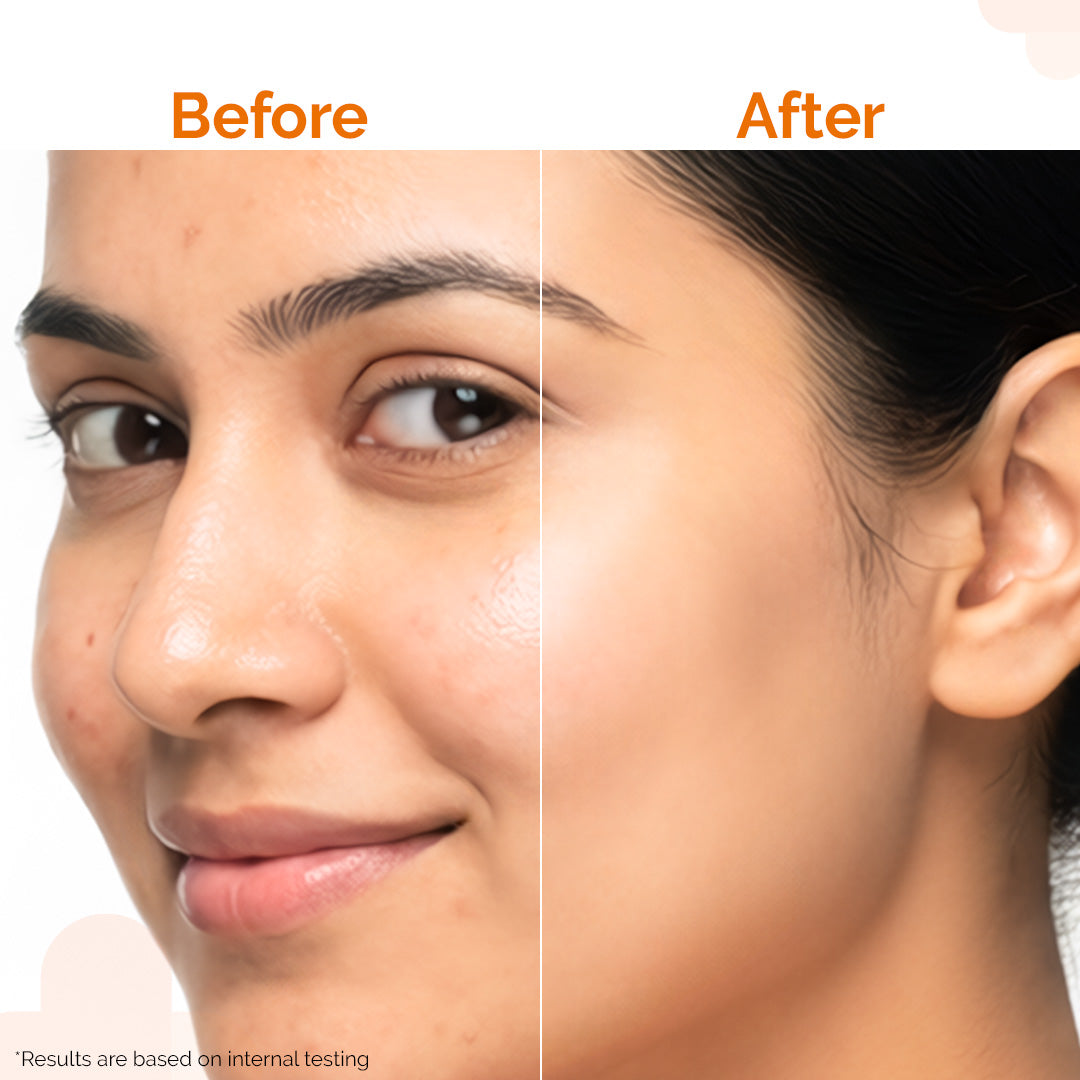 Pore Minimizing Priming Sunscreen For Open Pores & UVA/UVB Protection - 80g