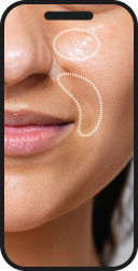 Skin analysis example