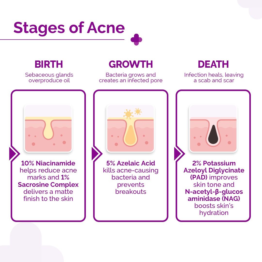 Nia-Zelaic Oil Control Face Serum - 30 ml