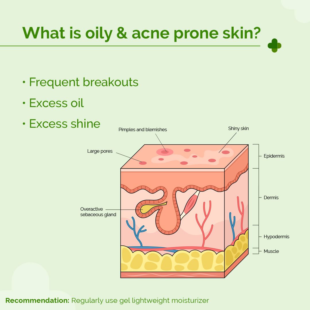 5% Nia-Ceramide Mattifying Moisturizer with 5% Niacinamide & 2% Ceramide - 100g